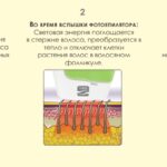 ФОТОЭПИЛЯЦИЯ В ДОМАШНИХ УСЛОВИЯХ – РЕАЛЬНОСТЬ.